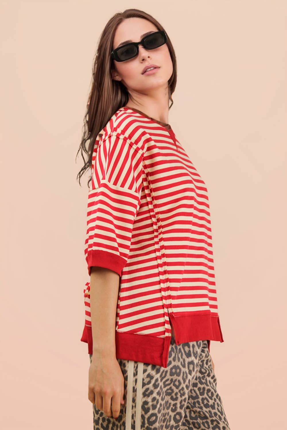 Tinley Oversized Stripe Top